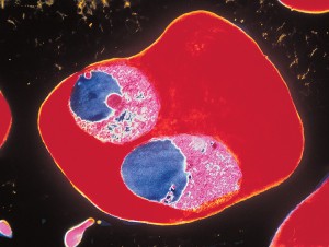 Protozoans, such as the malaria parasites shown here in pink and blue, cause many painful and disabling diseases. Credit: © CNRI/SPL from Photo Researchers