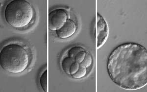 "This sequence of images shows human embryos that possessed a genetic mutation known to cause a fatal heart condition that were treating using gene-correcting technology known as CRISPR-Cas9. The embryos are healthy and can be seen to divide normally. A baby from such an embryo would be free of the harmful genetic condition." This sequence of images shows the development of embryos after co-injection of a gene-correcting enzyme and sperm from a donor with a genetic mutation known to cause hypertrophic cardiomyopathy. A new study, published today in the journal Nature, demonstrates an effective method of repairing a disease-causing mutation from the moment of fertilization, preventing it from being passed to future generations. Credit: © Oregon Health & Science University 