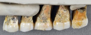 Right upper teeth of the individual CCH6. Credit: © Callao Cave Archaeology Project
